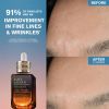 Advanced Night Repair Serum Synchronisé Multi-Récupération Complexe Commentaires